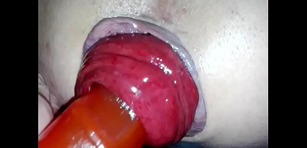  anal-extreme-gay-plug-prolapse-pump-rosebud gay prolapse